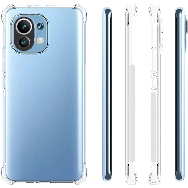 Xiaomi Mi 11 Lite Kamera Korumalı Shockproof Şeffaf Silikon Kılıf-(5775) 2 Xiaomi Mi 11 Lite Kamera Korumalı Shockproof Şeffaf Silikon Kılıf-(5775) - Görsel 2