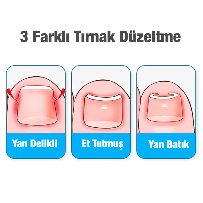 Ezere 24 Parça Profesyonel Tırnak Bakım ve Onarım Manikür Pedikür Seti 4 Ezere 24 Parça Profesyonel Tırnak Bakım ve Onarım Manikür Pedikür Seti - Görsel 4