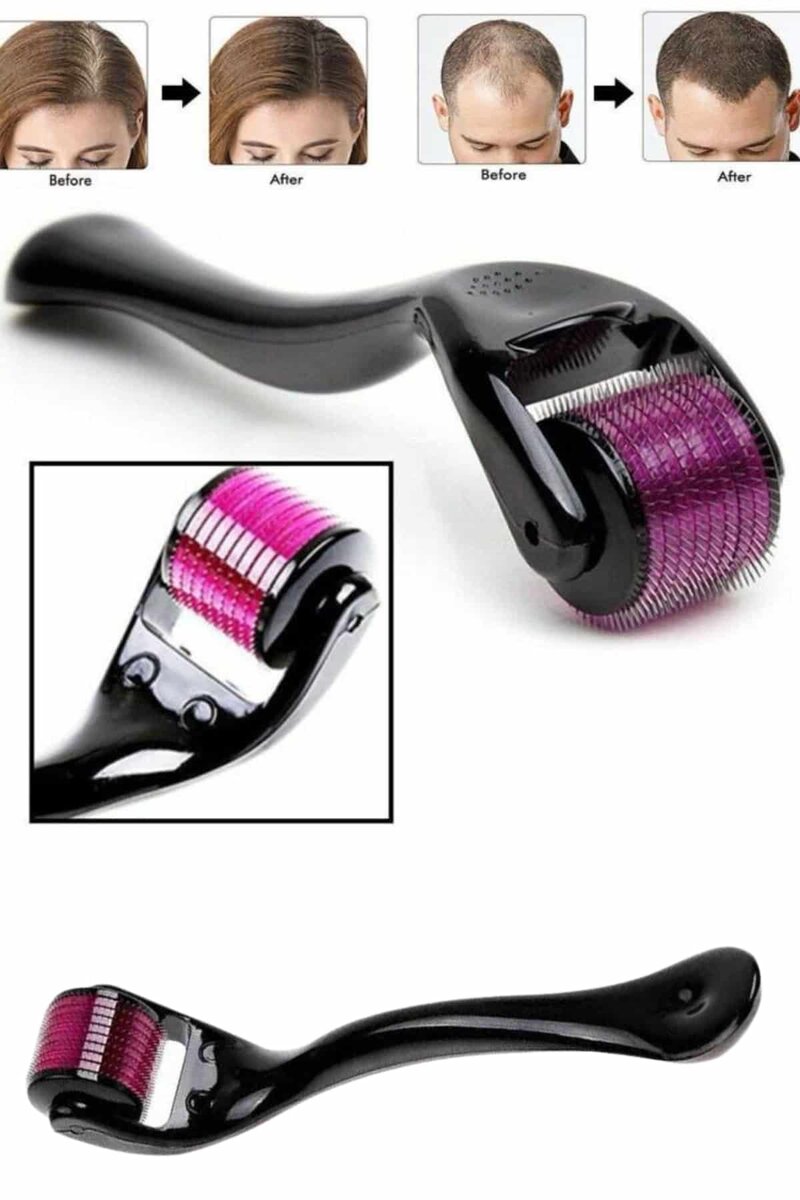 Derma Roller Titanyum Uçlu 540 İğneli 1 Mm Saç Sakal Çıkarma Ve Cilt Bakım Masaj Aleti 2 Derma Roller Titanyum Uçlu 540 İğneli 1 Mm Saç Sakal Çıkarma Ve Cilt Bakım Masaj Aleti - Görsel 2