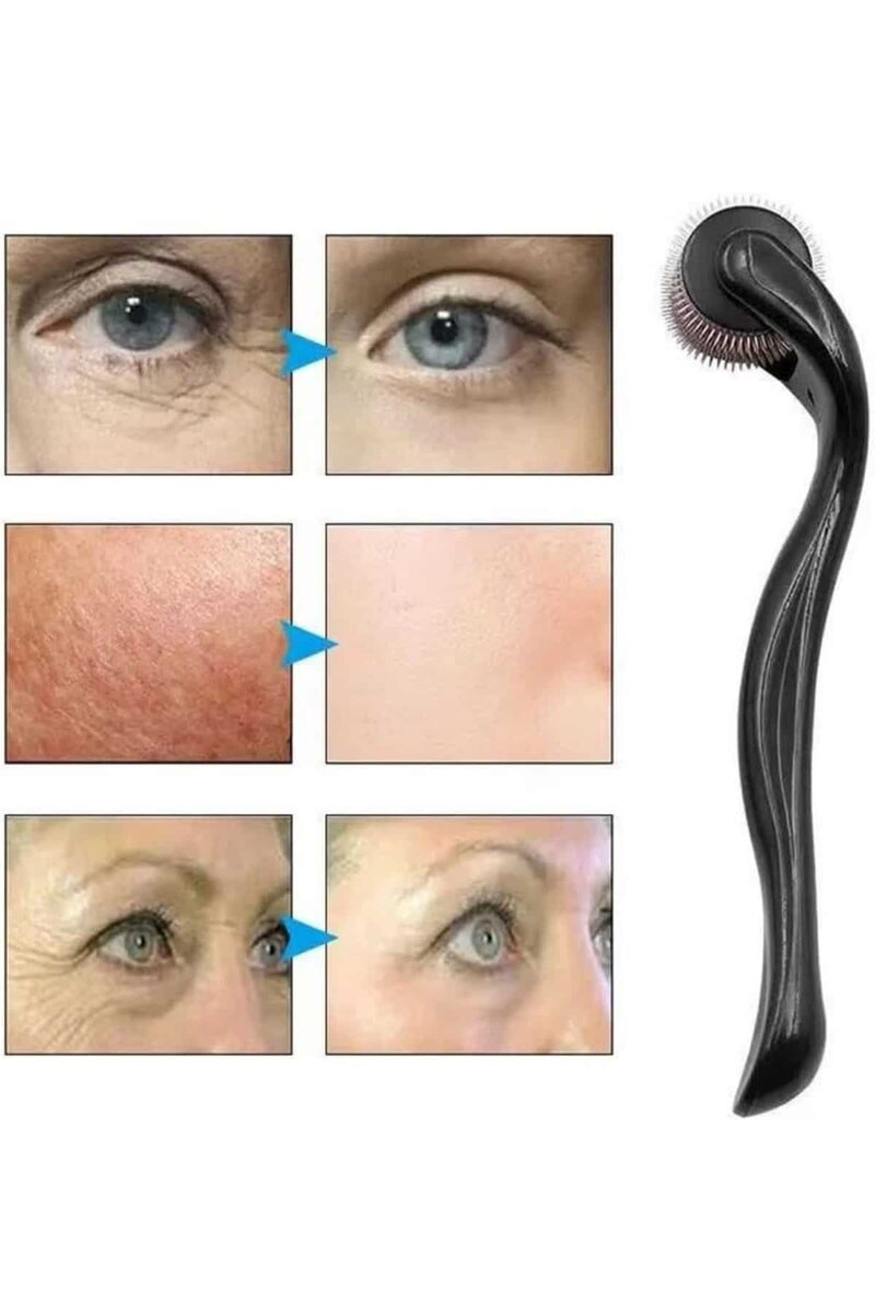 Dermaroller Titanyum 540 Iğneli 1 Mm Saç Kaş Sakal Serum Kullanıma Uygun 3 Dermaroller Titanyum 540 Iğneli 1 Mm Saç Kaş Sakal Serum Kullanıma Uygun - Görsel 3